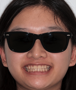 Smile 045