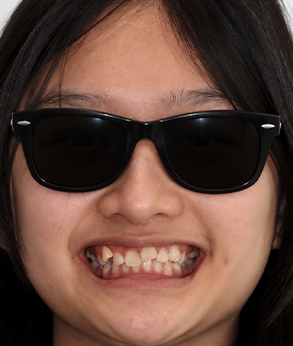 Smile 045