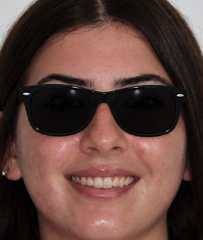 Smile 047