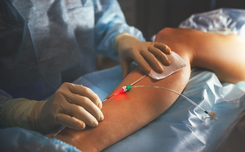 The Best Varicose Veins Treatment Options