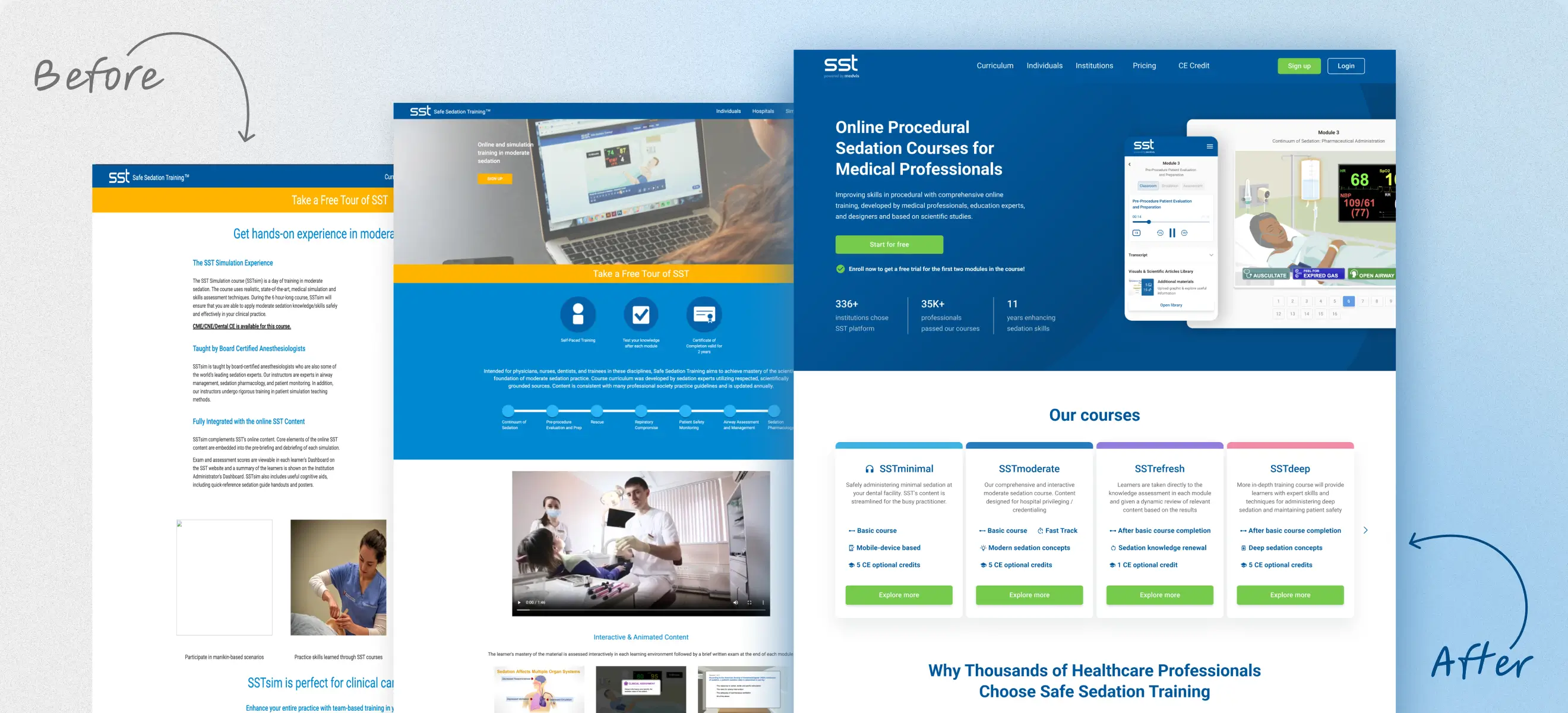 Before-and-after comparison of the Safe Sedation Training (SST) website redesign, showing the old layout on the left and the modernised, user-friendly version on the right.