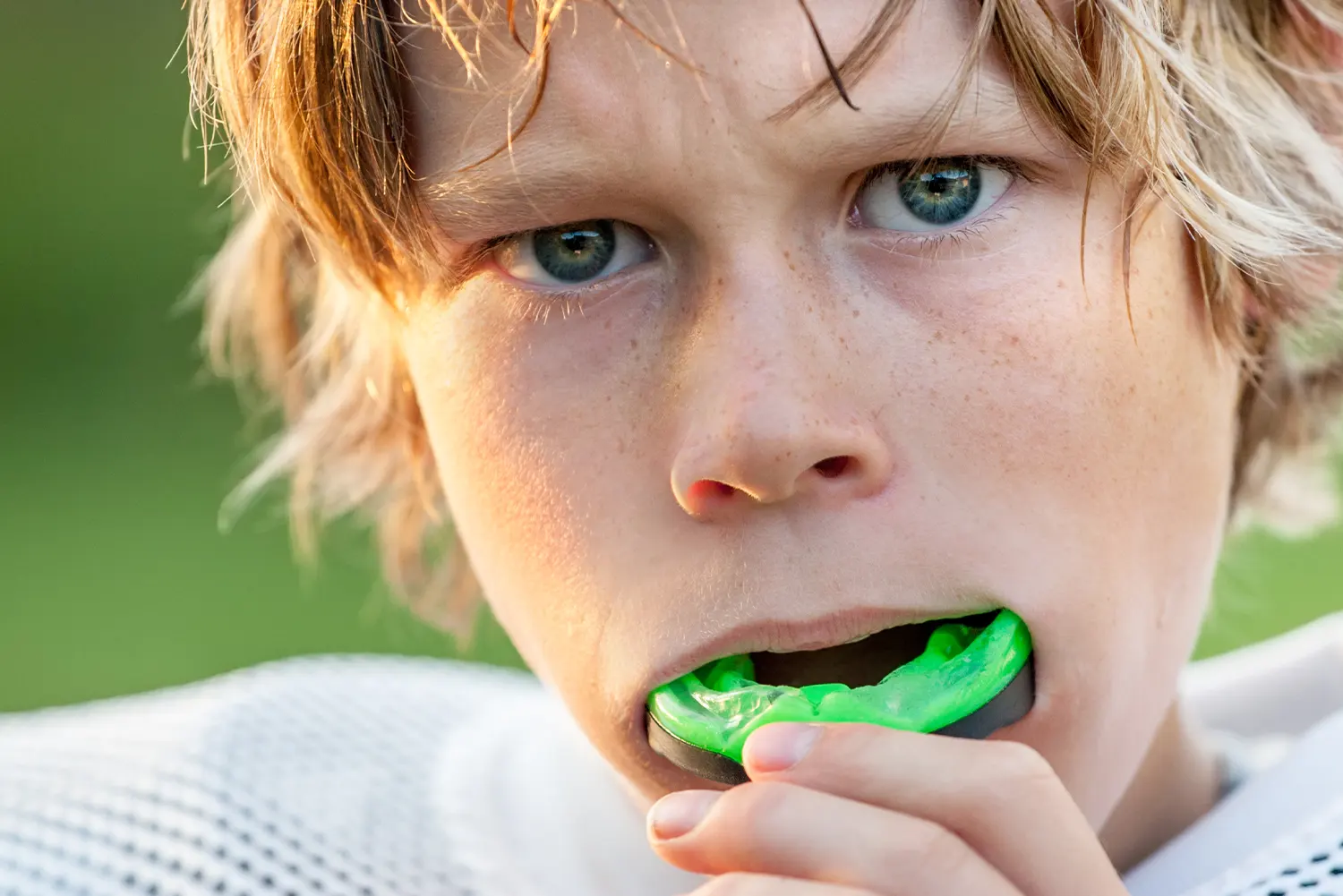 Mouth Guards in Woodstock, GA | Holly Springs Dental