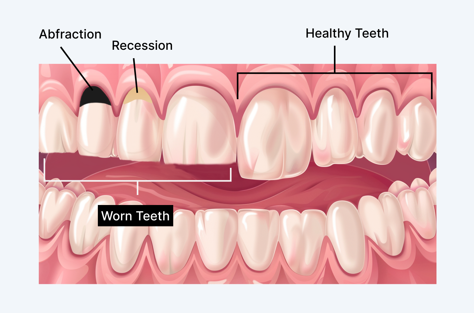 Custom Mouthguard service at Houston Dental Oasis in Houston Heights, TX