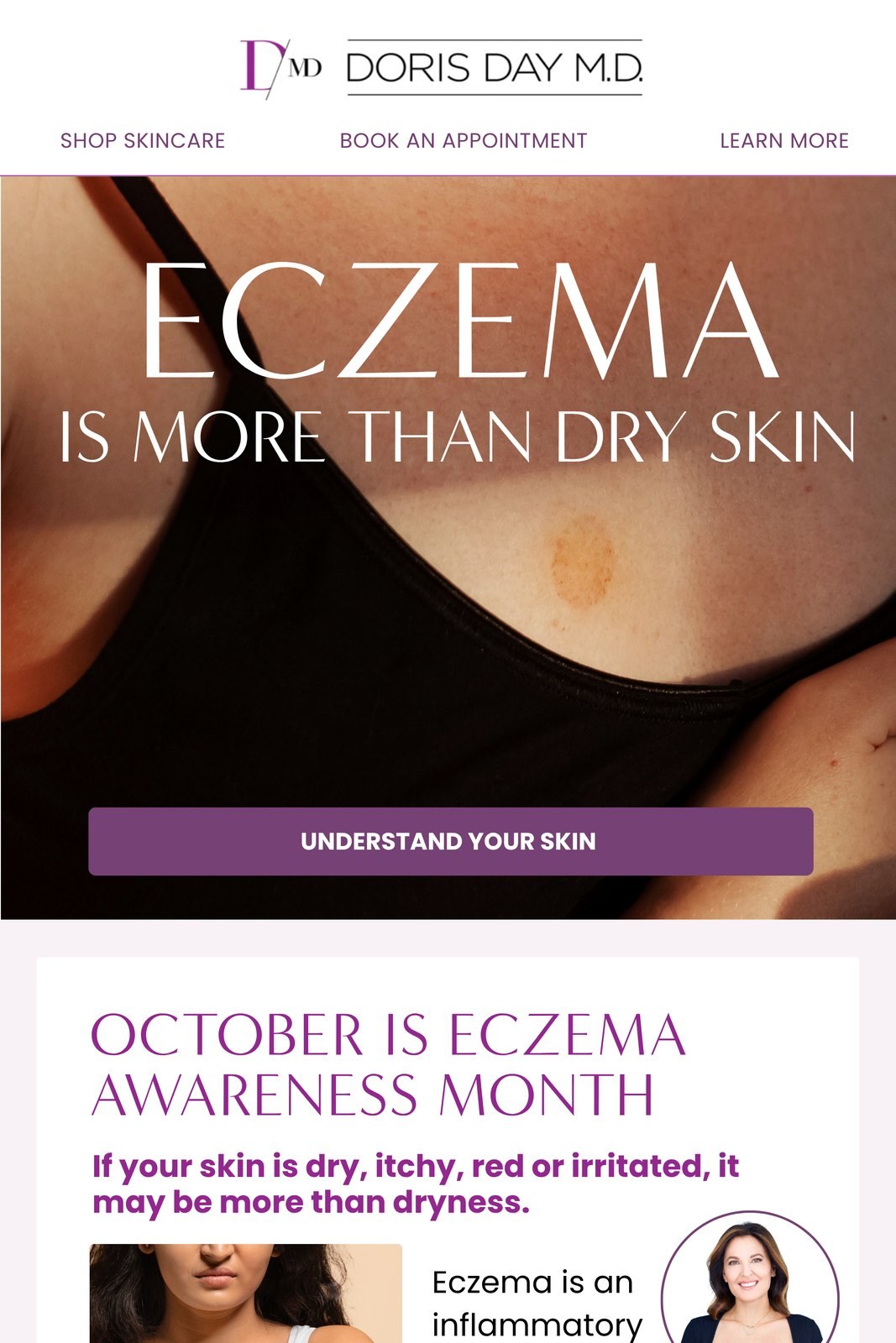Doris Day M.D. eczema awareness email