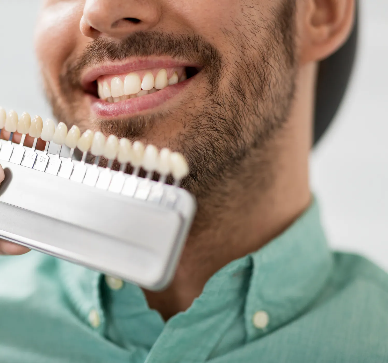 Veneers