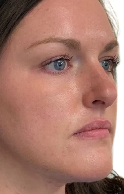 photo of individual before tox