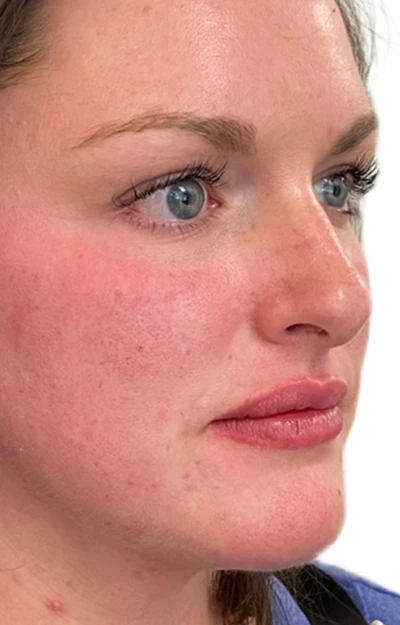 photo of individual after tox
