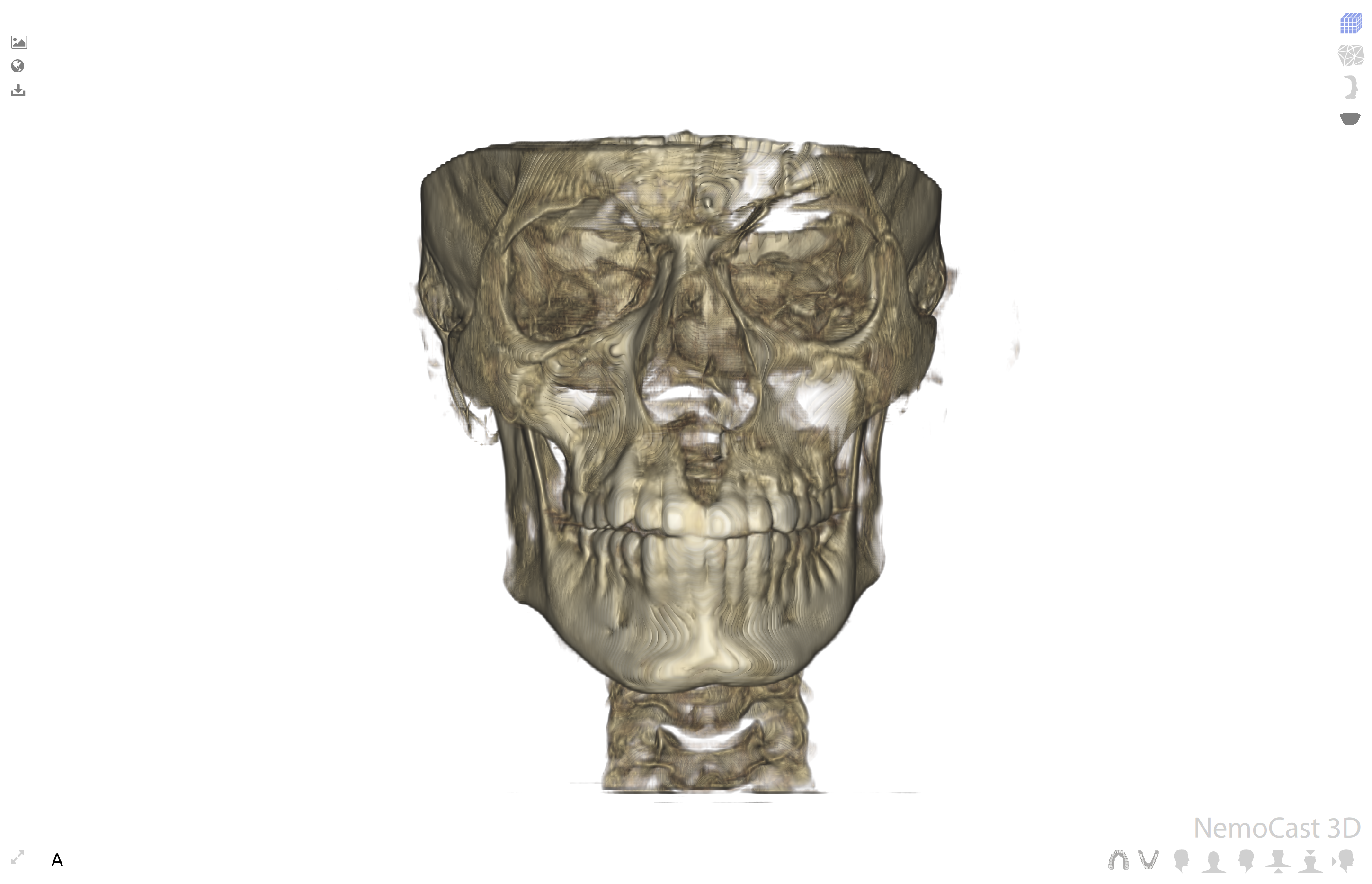 MARPEFACE protocol for Facial changes