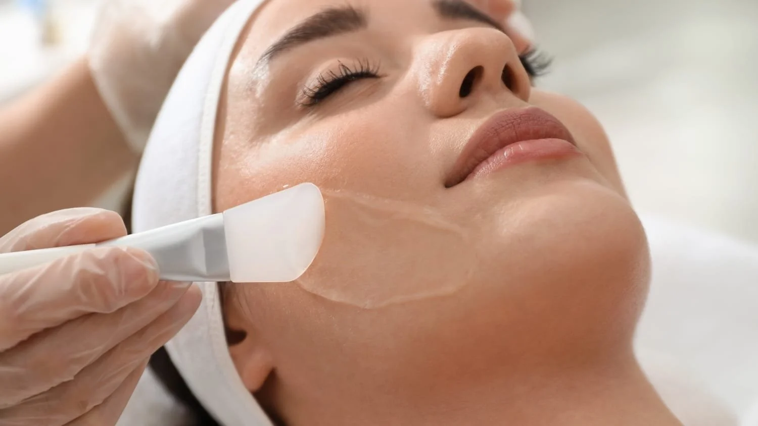 Elevate Your Skincare with Regular Light Chemical Peels