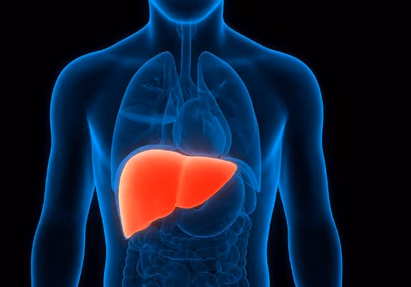 Medical illustration showing an inflamed liver in the human body, indicating Grade 3 fatty liver disease.