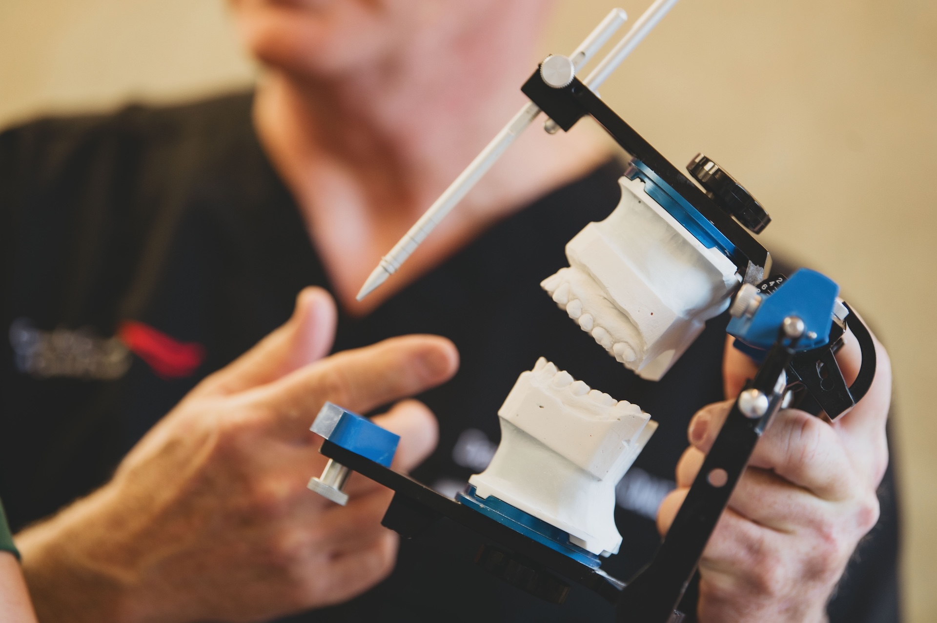 Why Choose All-on-X for Full Arch Restoration