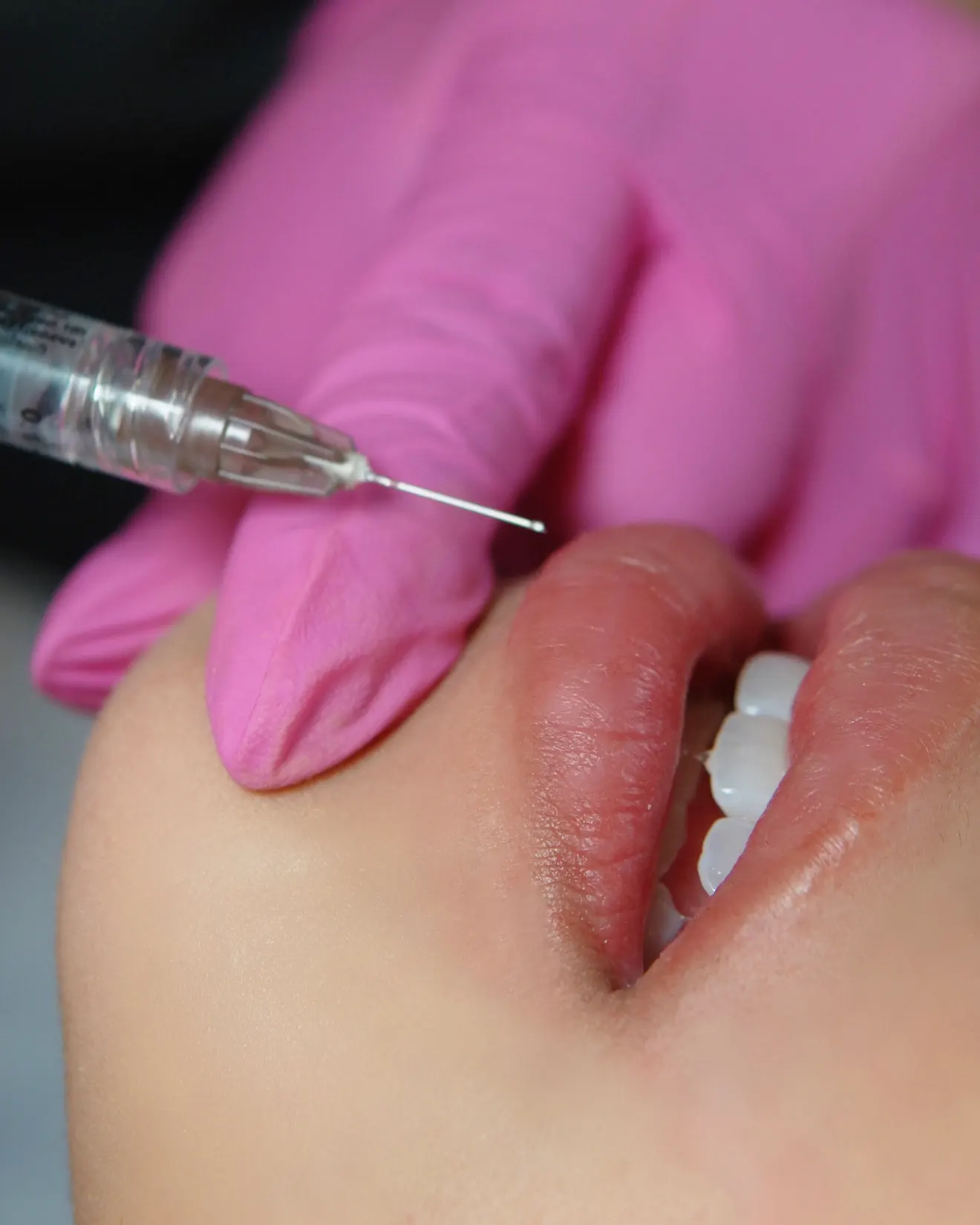 Kalos & Muse Injectables Target Image 1