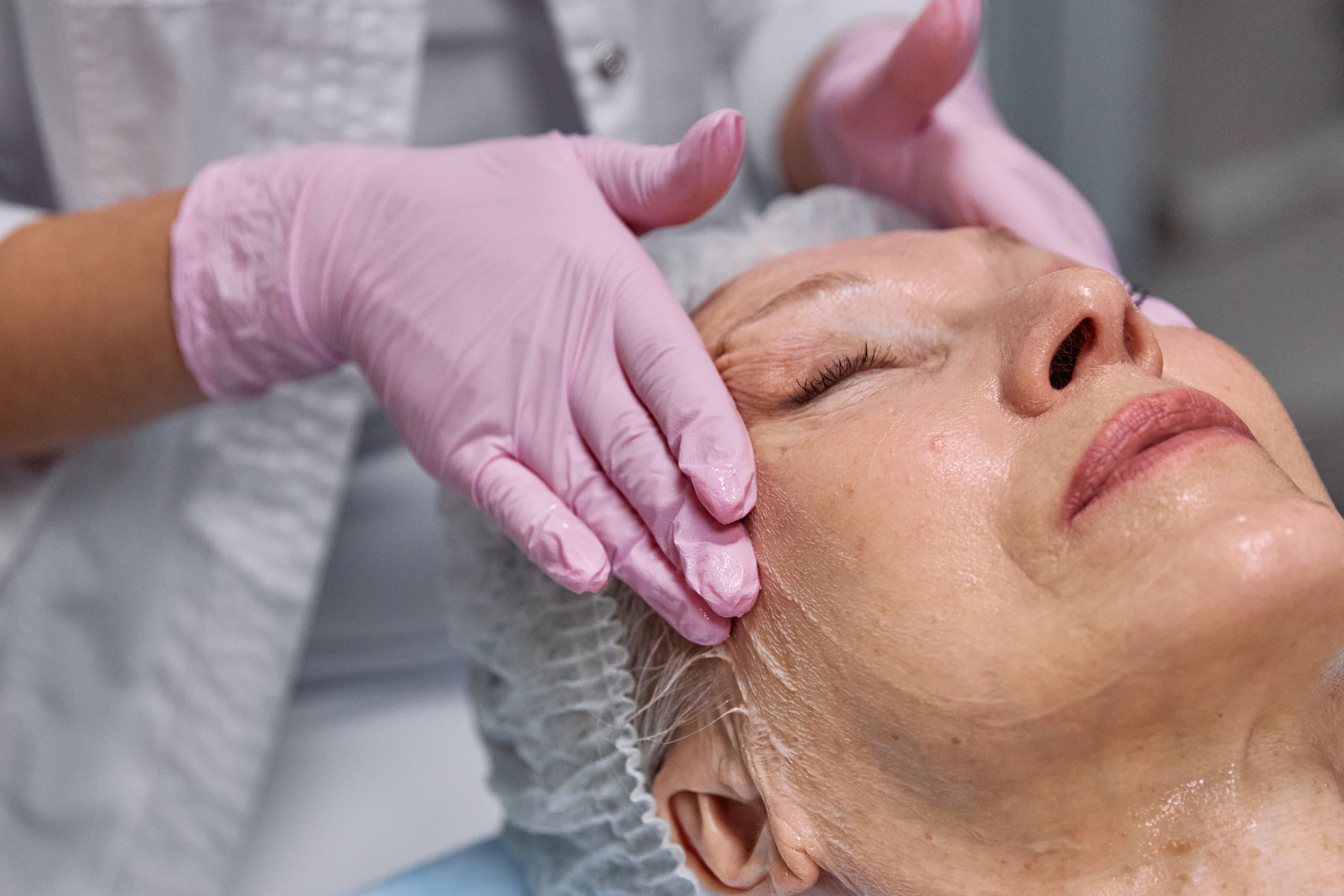 Esthetician performing a DEJ BioStim chemical peel treatment at Kalos & Muse medspa in Richardson TX