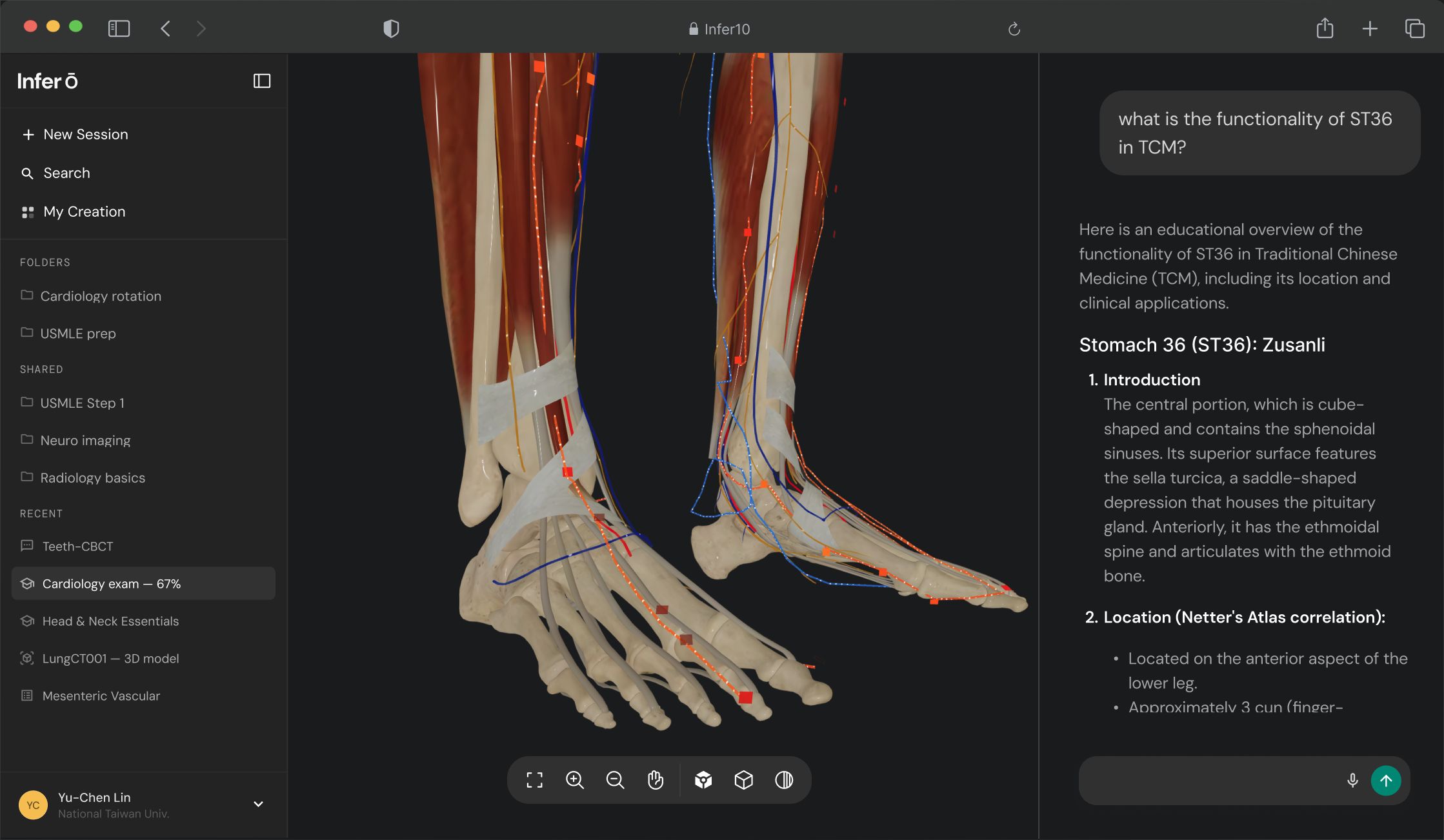 Holistic anatomical view layering meridians over neurovasculature
