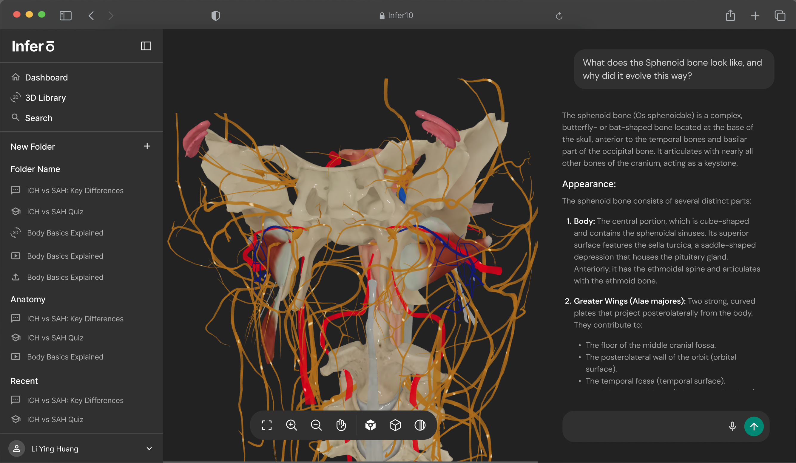 Infer10 3D anatomical model of a sphenoid bone in the browser