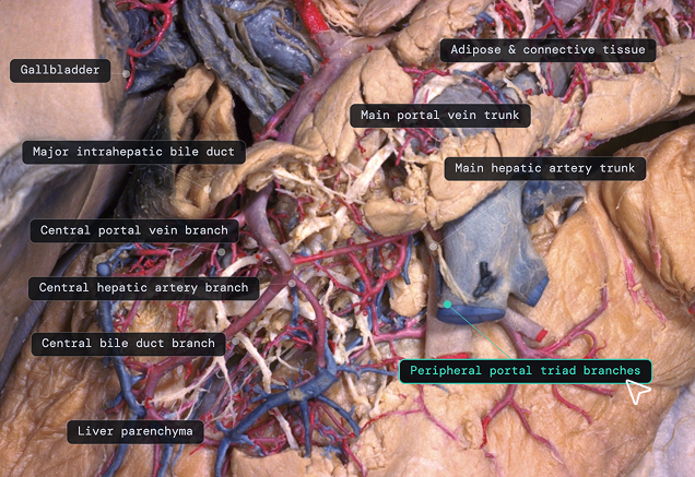 Automated medical image interpretation with clickable labels
