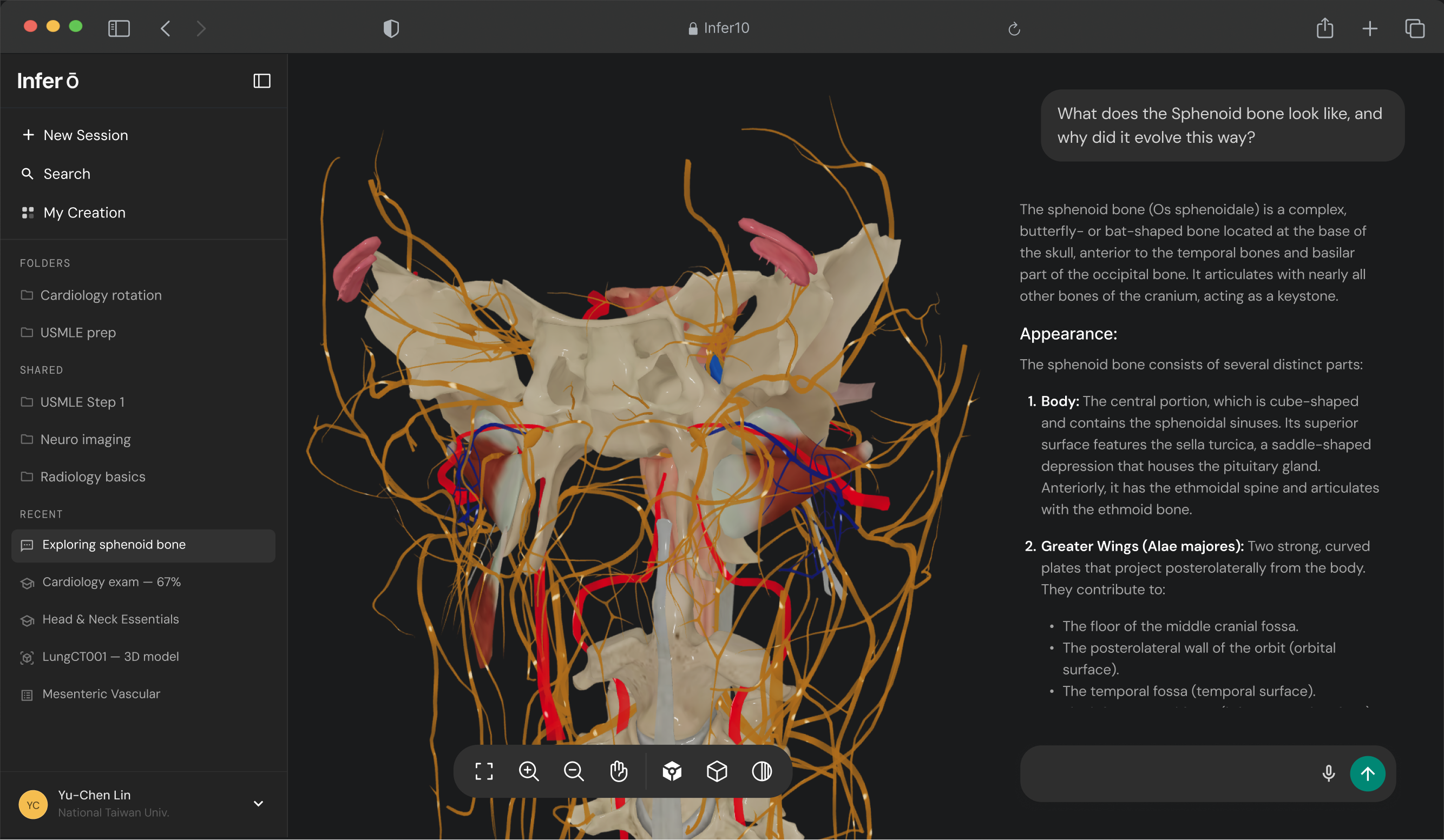 Visualize complex anatomical structures in 3D