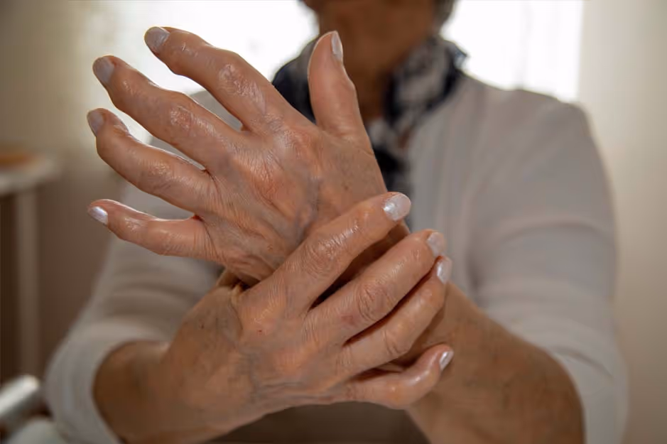 Close-up of an elderly person clasping one hand over the other, showing detailed skin texture.