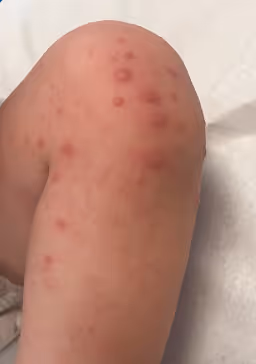 Tatuagem no braçoDescrição gerada automaticamente