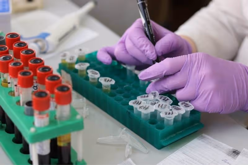 Hands in purple gloves labeling small test tubes in a green rack next to blood sample tubes with red caps.