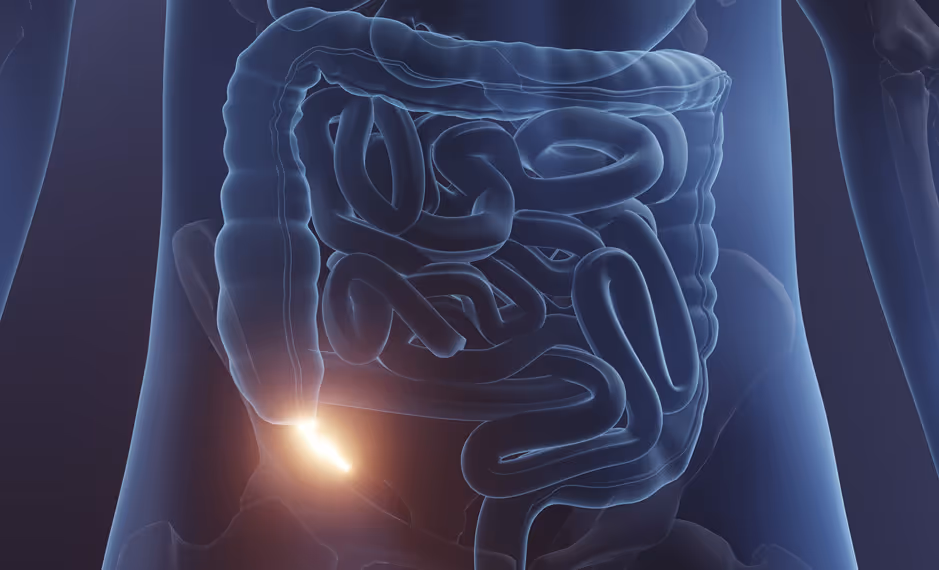 Transparent torso showing intestines with a bright light highlighting the appendix area.