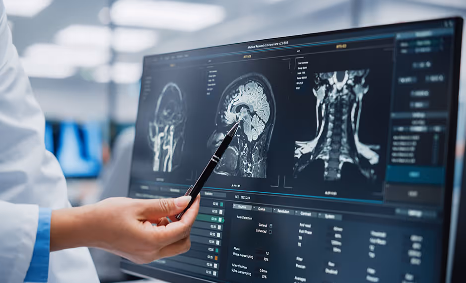 Doctor pointing at brain and spinal cord MRI images on a medical research computer screen.