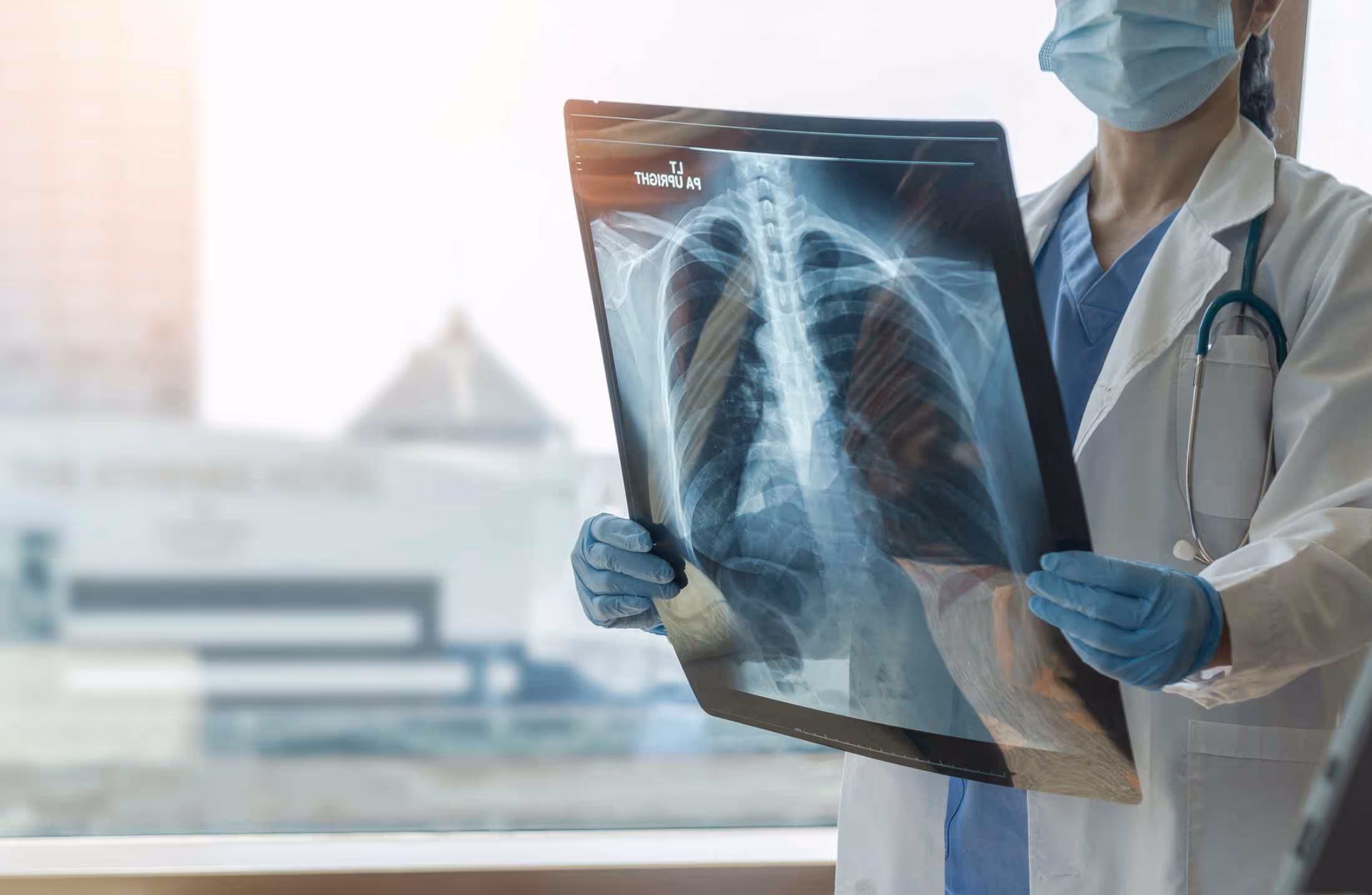 Doctor in mask and gloves holding a chest X-ray film showing ribs and spine.