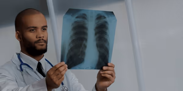 Male doctor in white coat holding and examining a chest X-ray image indoors.