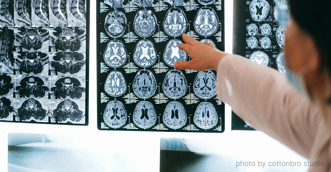 Brain injury scans