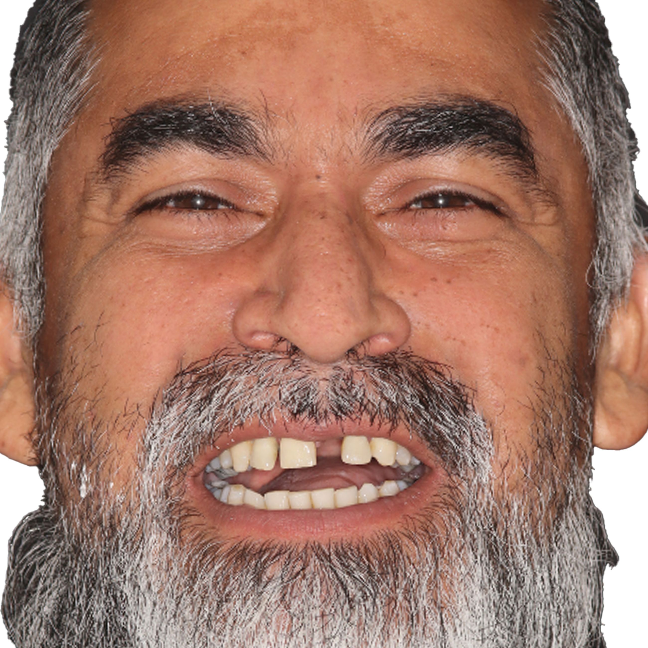 Nuvia Dental Implant Center Jobs - 2x0lkak