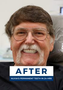 Man smiling after getting dental implants