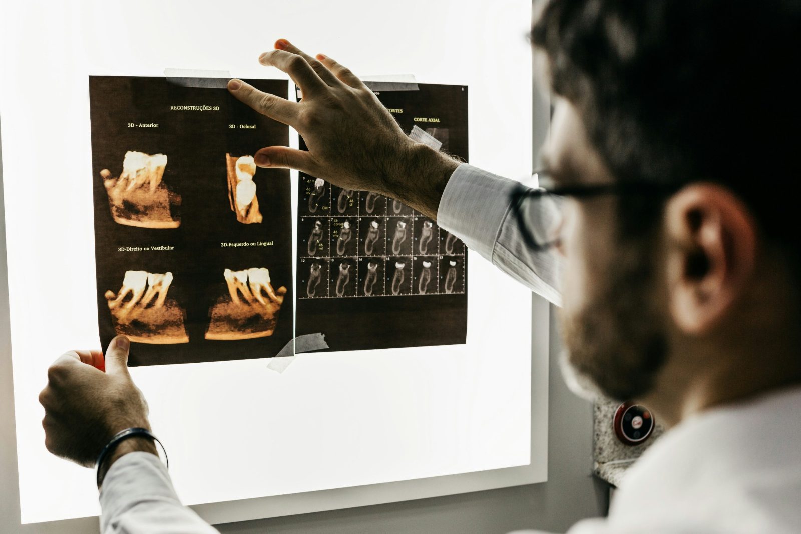 Lekarz dentysta analizuje zdjęcia RTG zębów