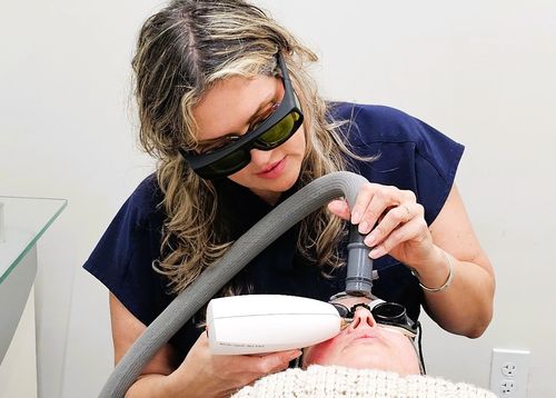 Laser treatment for pigmentation and rosacea