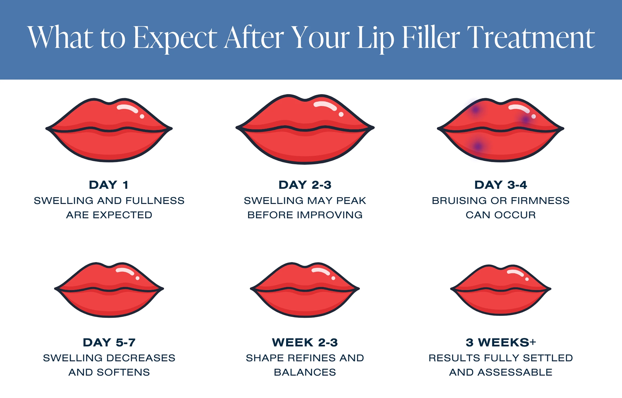 What to expect after your lip filler treatment