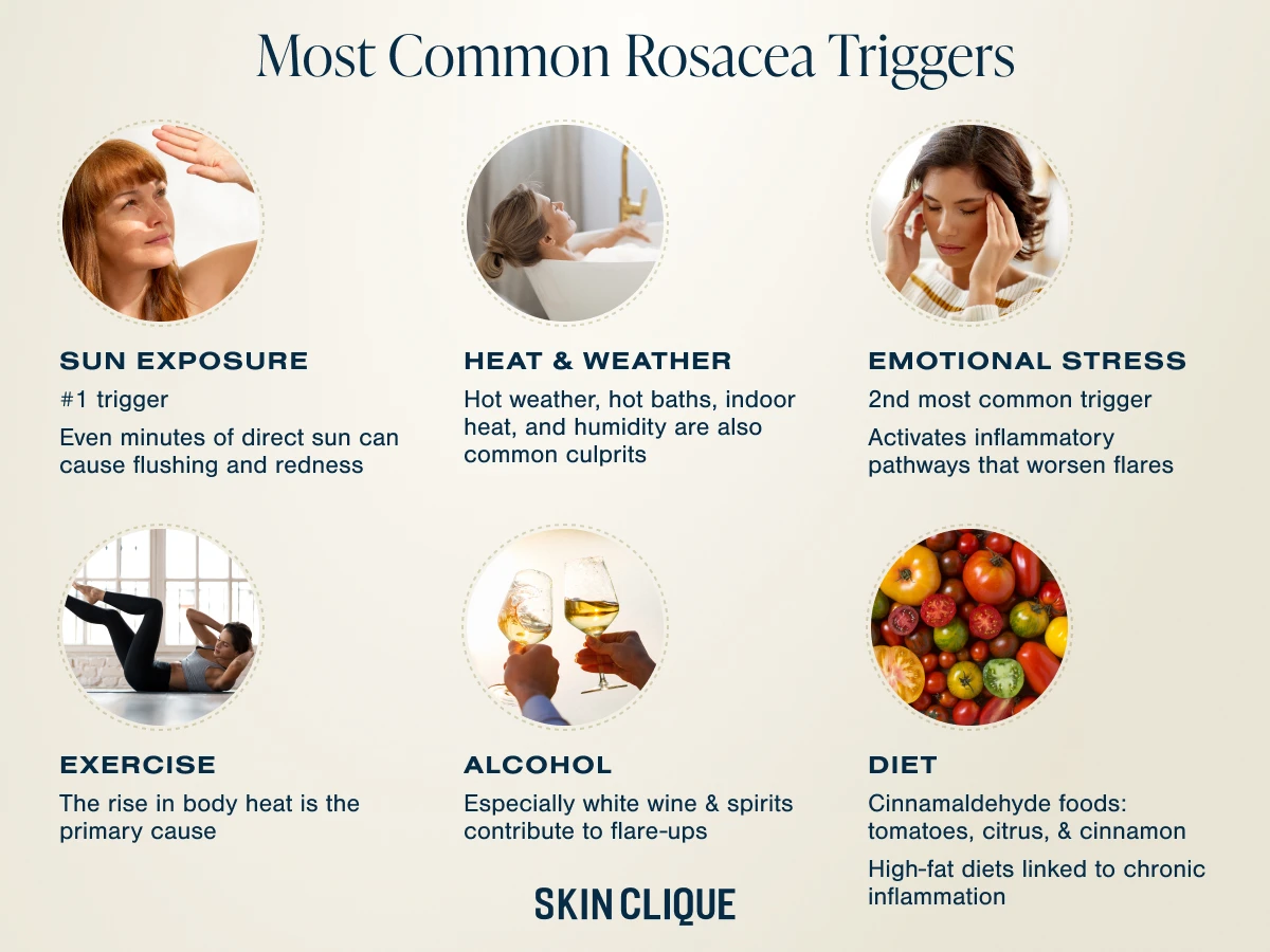 Commn rosacea riggers