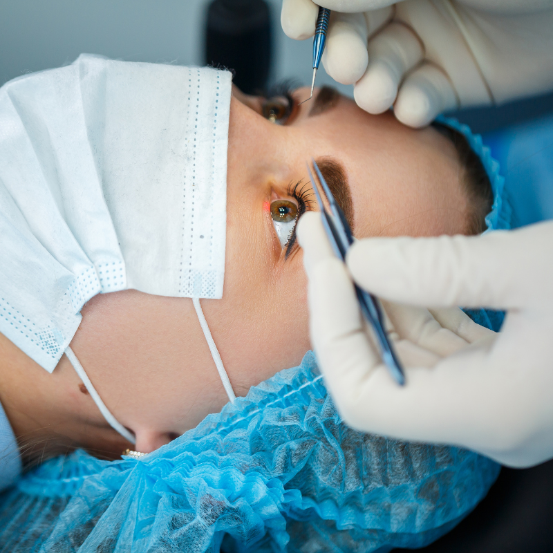 eye stye and chalazion