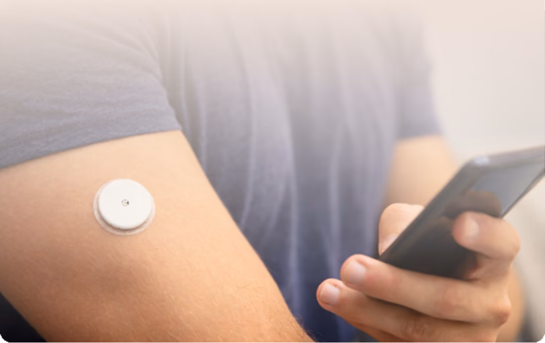 Persona con sensor de monitoreo continuo de glucosa en el brazo usando un teléfono móvil.