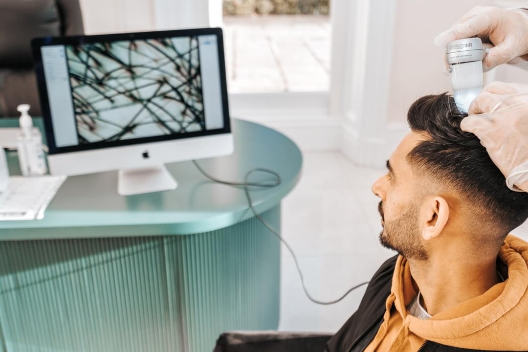 What makes FUE Hair Transplant Procedure the most Successful Technique?
