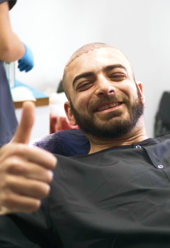 Mohammed FUE Hair Transplant Story - Este Medical