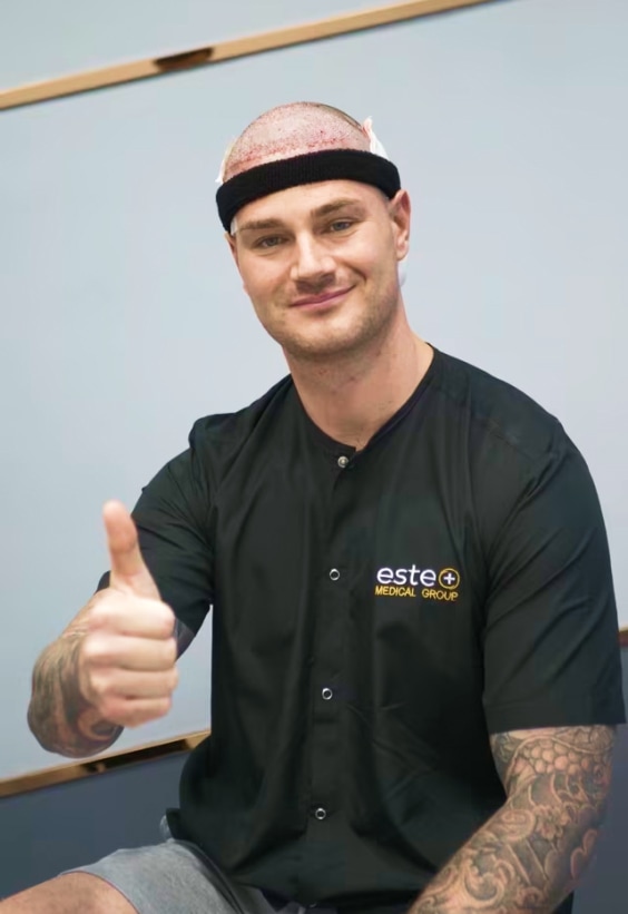 Ashley FUE Hair Transplant Story - Este Medical