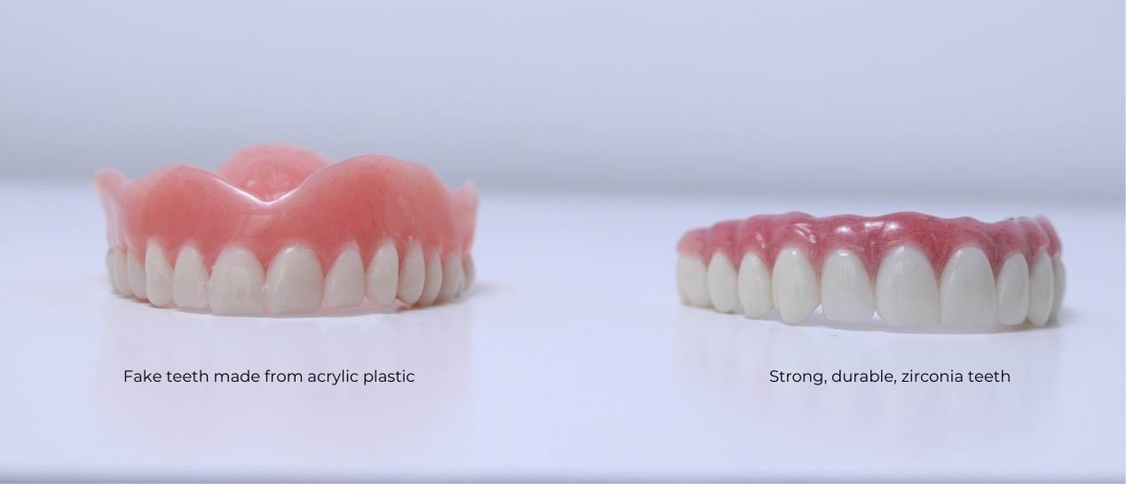Fake teeth made from acrylic next to fake teeth made from zirconia