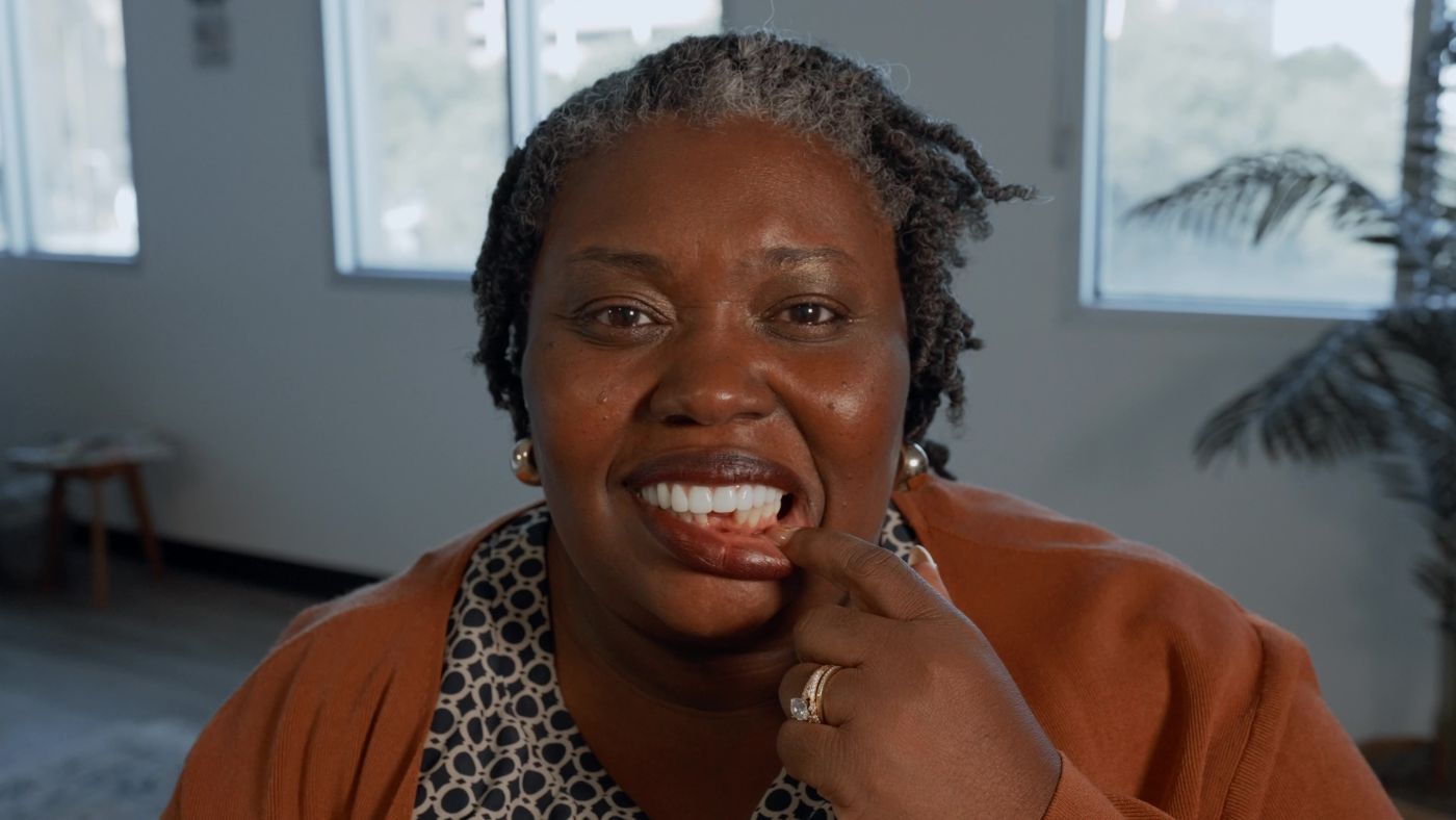 Woman pulling down lip to show the gap in her bottom teeth
