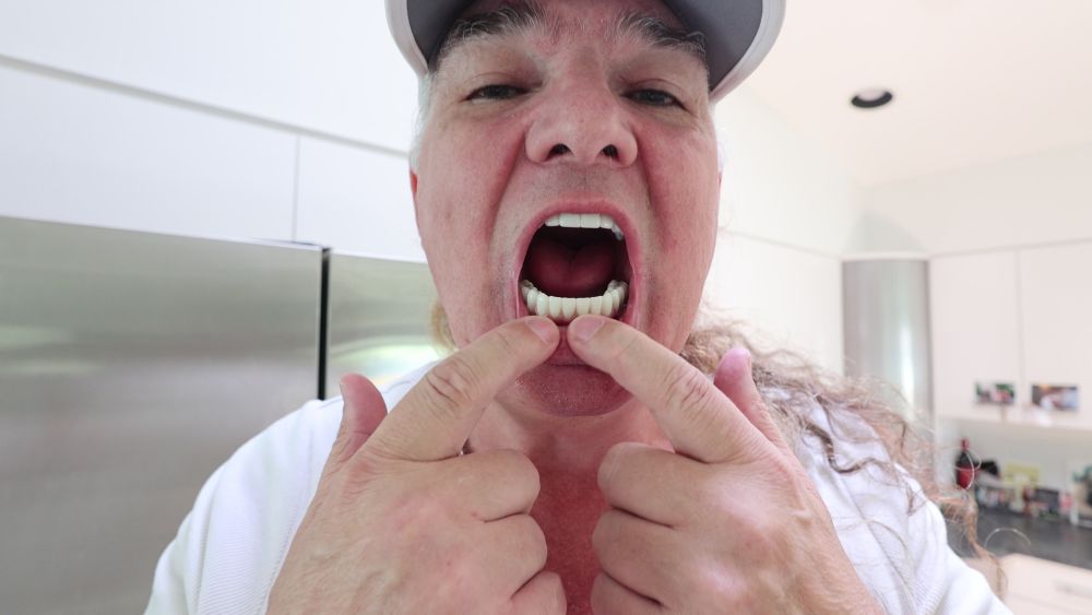 Patient shows his new Nuvia teeth up close