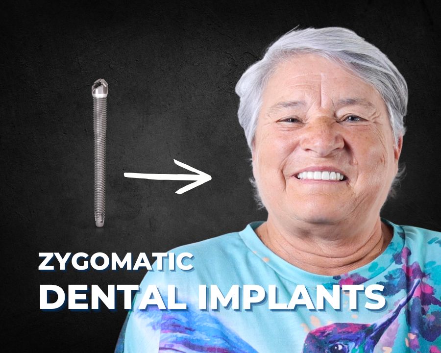 Woman smiling with new teeth next to zygomatic dental implant