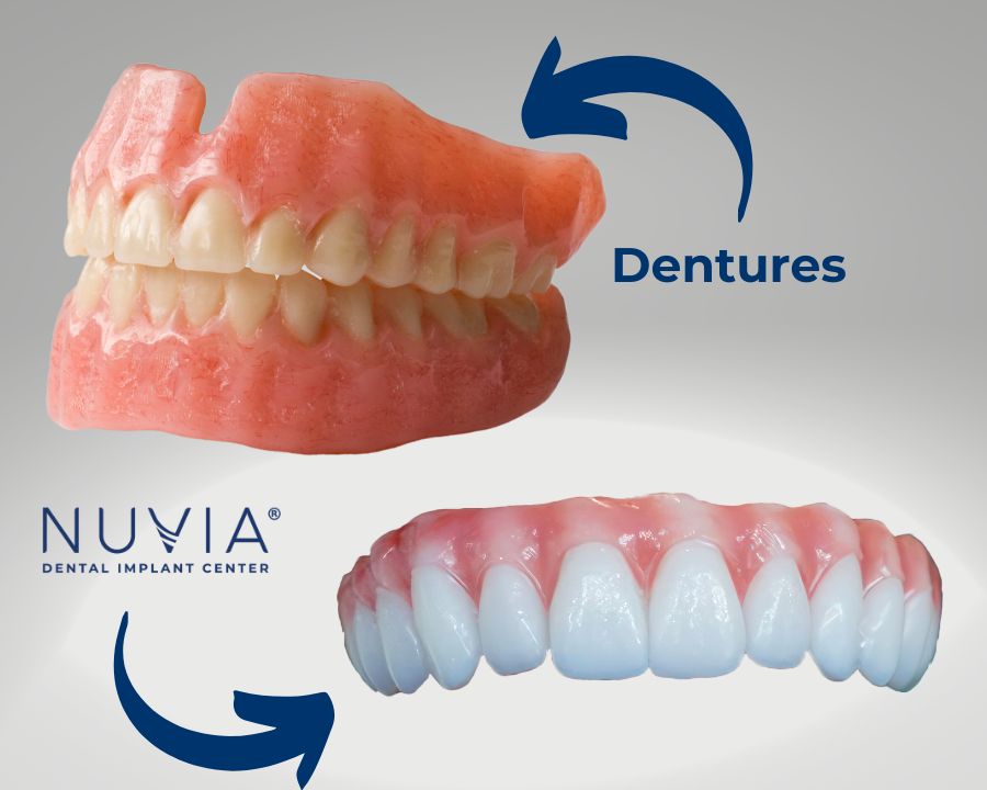Image of dentures next to image of Nuvia's permanent teeth