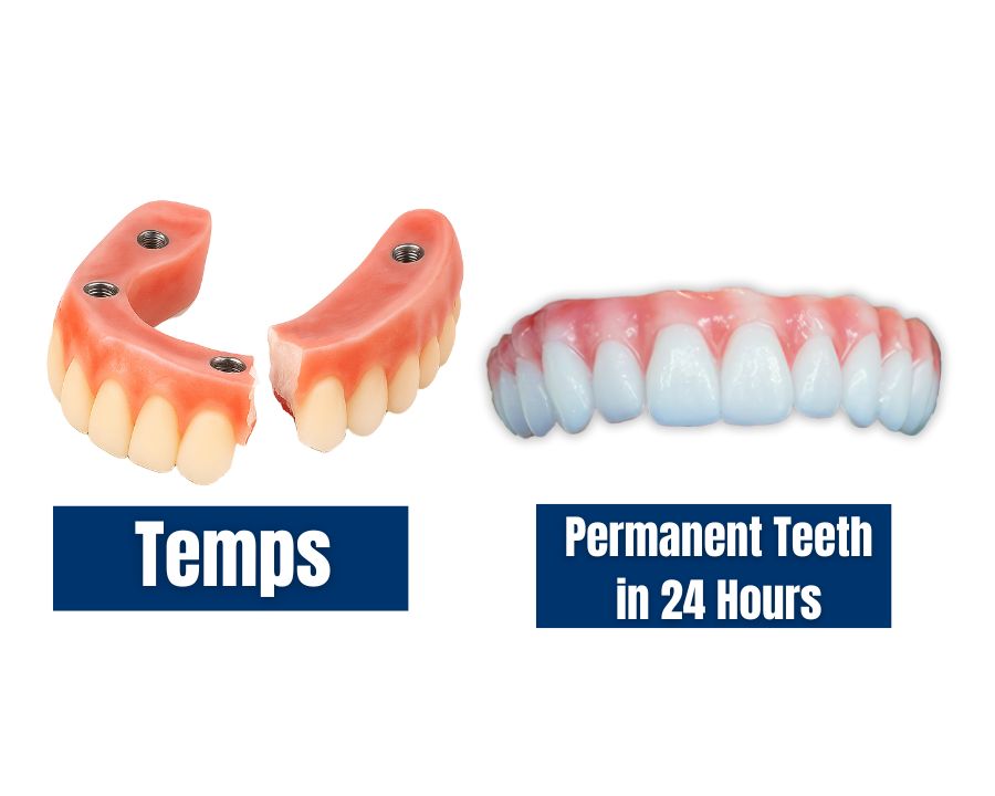A temporary set of teeth next to the permanent teeth from Nuvia