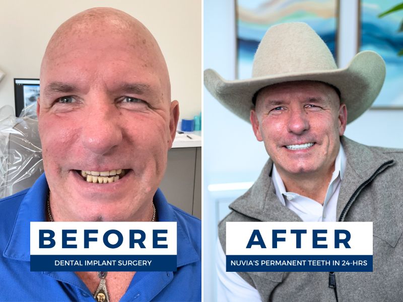 Ricky smiling before and after getting new zirconia teeth to help with his health
