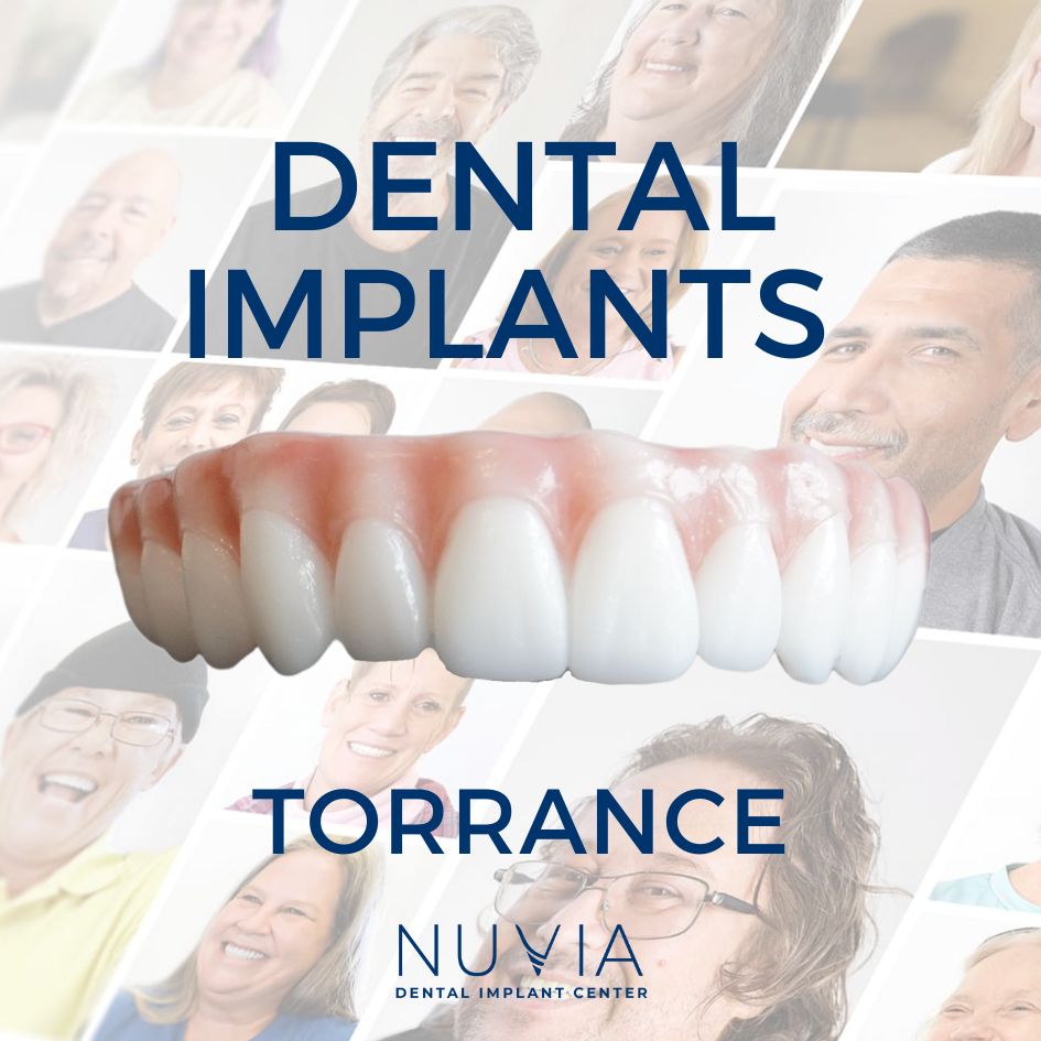 Graphic with dental implant prosthetic in Dallas