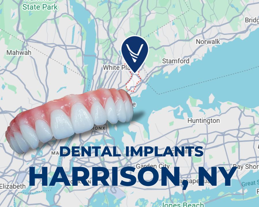 Dental Implant Blog Articles Graphic