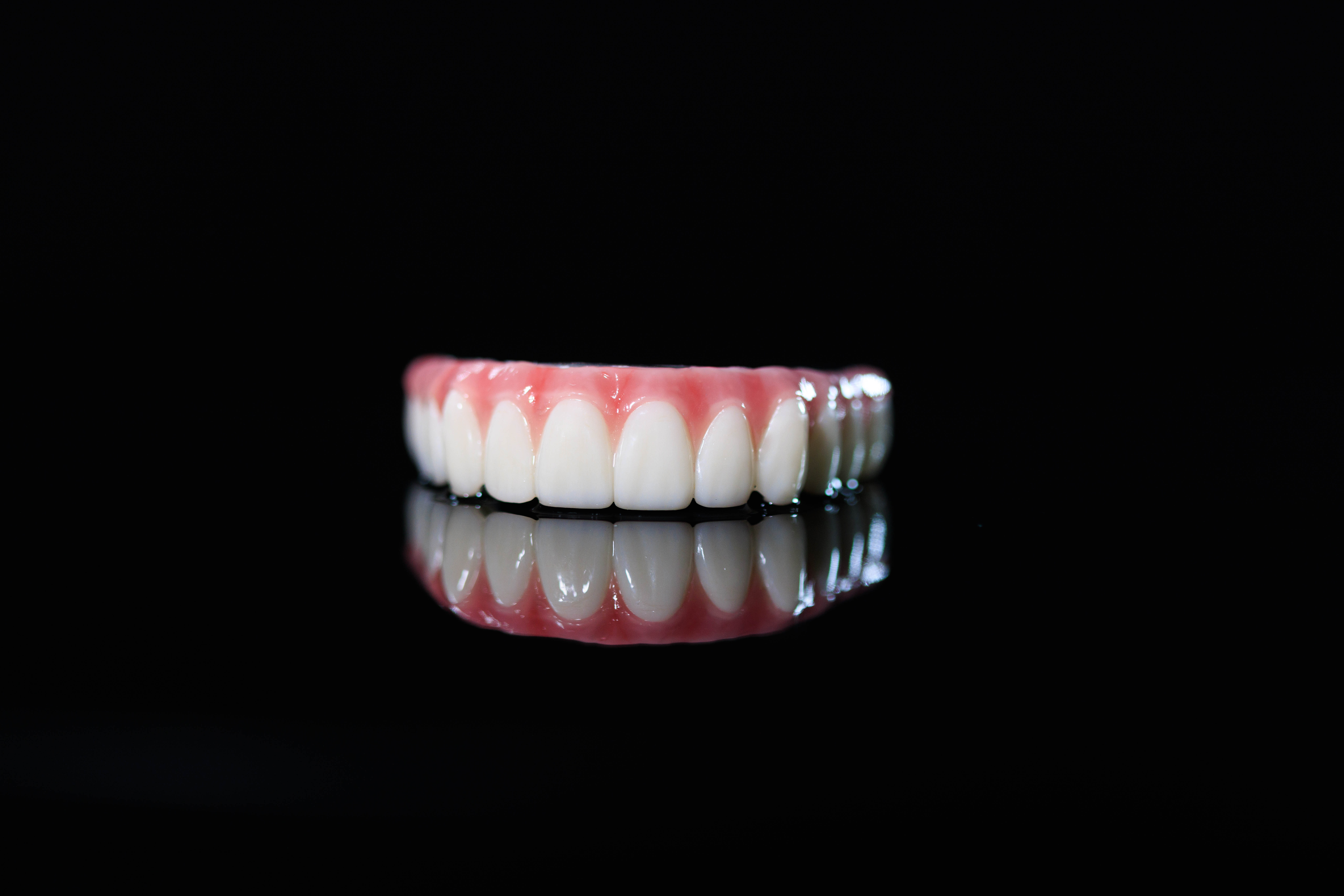 Close up of a top arch of permanent, zirconia teeth